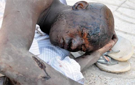 Inmigrante herido en las frontera con Melilla - Fuente eltelegrama.es Inmigrante herido en las frontera con Melilla - Fuente eltelegrama.es